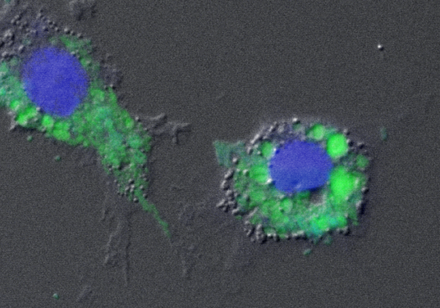 Confocal image 1