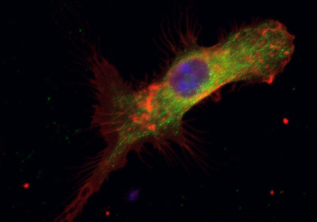 Confocal image 2